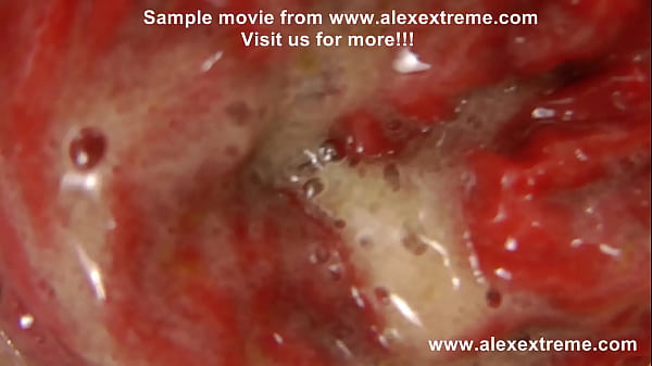 Play MP4 - Sexy firefighter Hotkinkyjo fuck her ass with red anal terrorist & prolapse