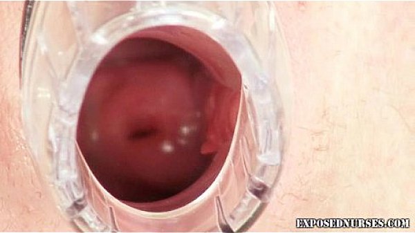 Teen nurse kinky pussy stretching on gynochair 