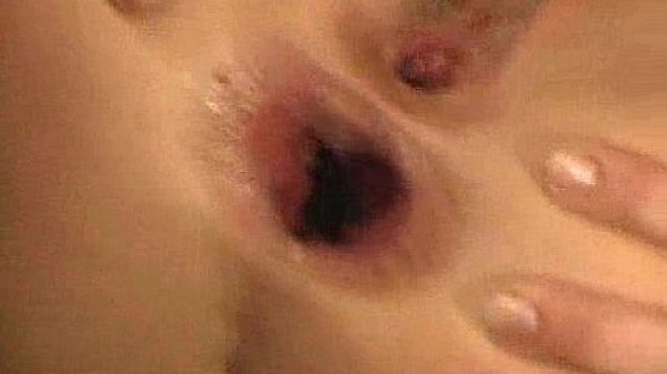 Anal gape 2 
