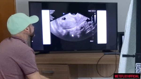 Play MP4 - Corno leva esposa no ginecologista clandestino fazer ultrassom&excl;