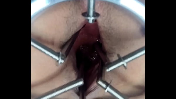 Te gustar&iacute;a ver el fondo de mi agujero? 