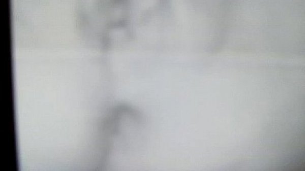 Nonton Jessica Gillson Plays Wit Pussy With Anal Beads In Her Ass thumbnail