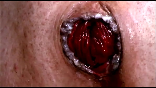 FREE! Double Anal, Gaping, Deepthroat and More!