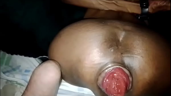 Play MP4 - Prolapso anal na Maga 2