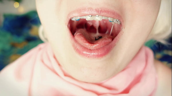 Asmr Mukbang: Eating In Braces thumbnail