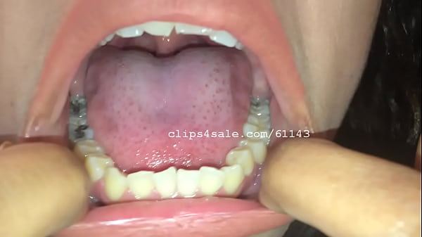 Play MP4 - Mouth Fetish - Lisa Mouth Video1