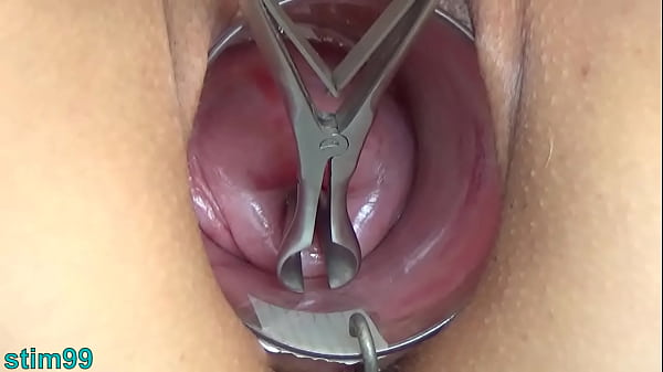 Play MP4 - Japanese Insemination with Cum into Uterus and Endoscope Camera by Cervix to watch inside womb Uncensored