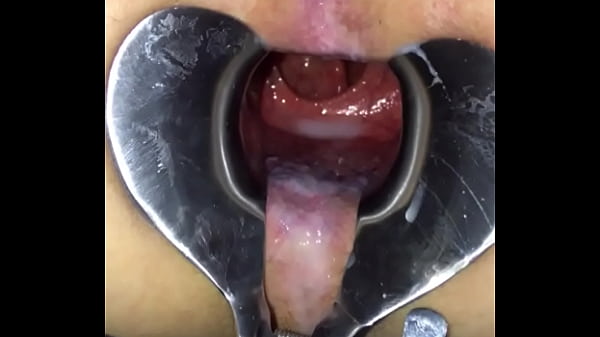 Playing with speculum 3