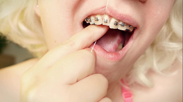 Mouth Fetish Tour - Cleaning - Dental Floss And Teeth In Braces thumbnail