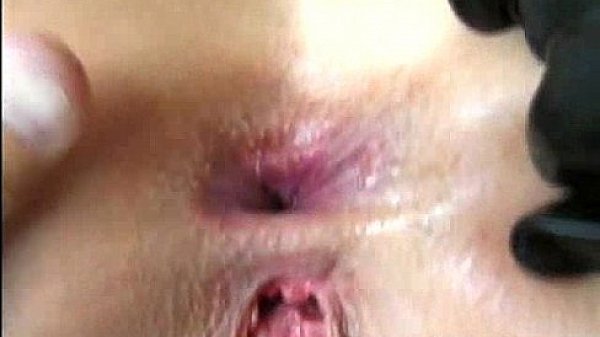 Euro gaping whores 413