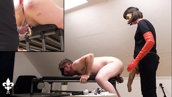 Full deep pegging dual view 