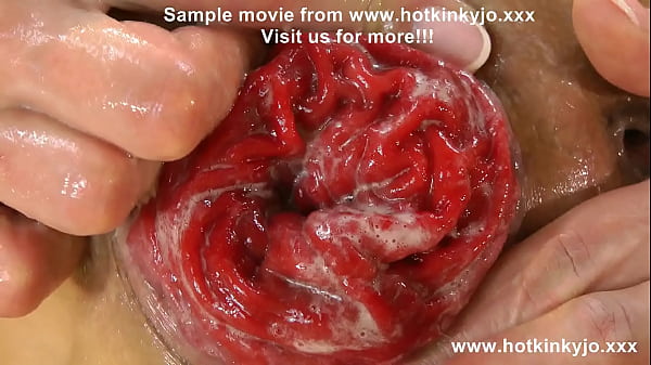 Play MP4 - Hot sparkling dress and anal fisting fun Hotkinkyjo &lpar;& prolapse&rpar;