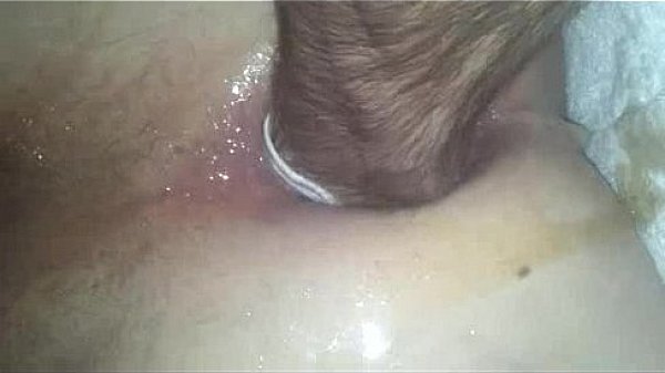 62135trimmed-000-20151024 2434 