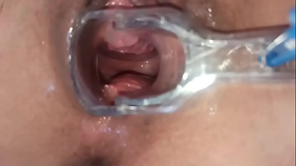 show my uterus close up 