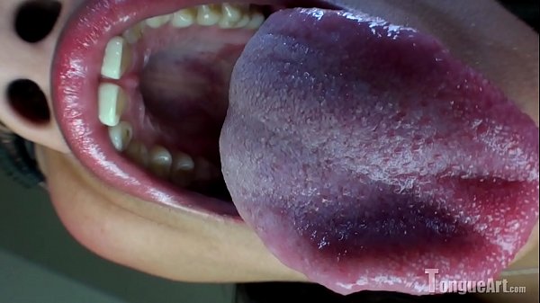 18 Year Old Opens Mouth thumbnail