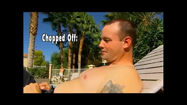 The man who lost his penis 