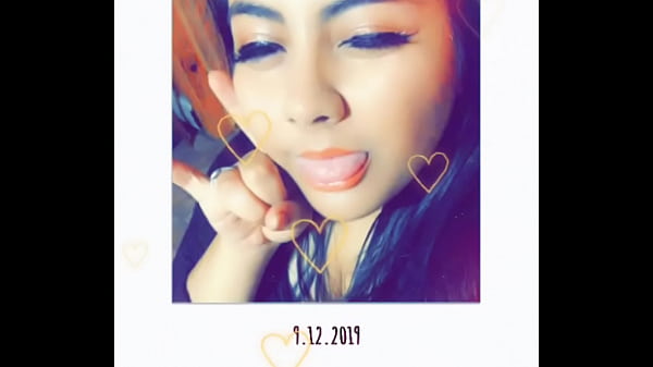 I got_a booboo and want you to kiss it better