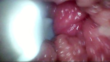 Nonton Endoscope Camera Records My Wife's G Spot. Educational Video thumbnail