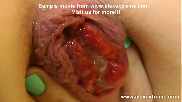 Play MP4 - Anal warrior Proxy Paige gape with anal plug