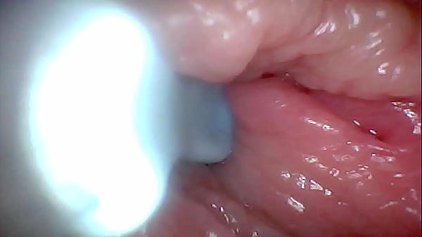 Play MP4 - First time&colon; An endoscope reveals the G-spot up close &ndash; without mounting&excl;