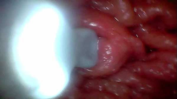 First time_An endoscope reveals the G spot_up close without mounting