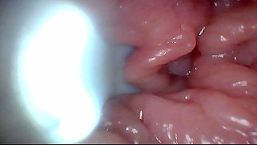 Nonton First Time: An Endoscope Reveals The G-spot Up Close &ndash; Without Mounting! thumbnail