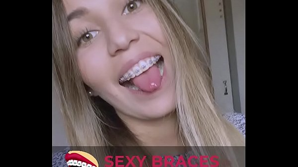 Sexy girls having braces compilation