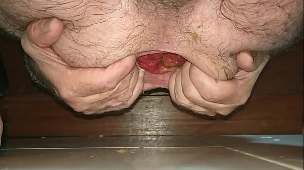 Giant plug stuffed in my loose hole backwards. 