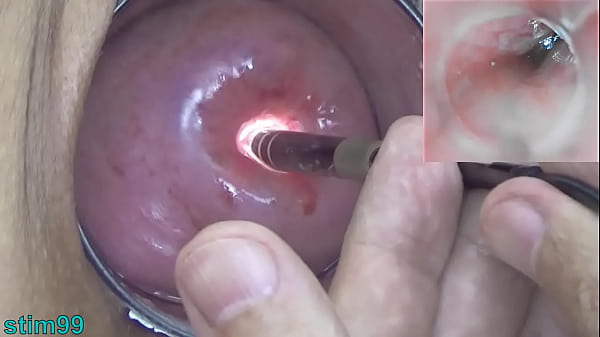 Play MP4 - Mature Milf Cervix Play with Endoscope Japanese Cam into Uterus
