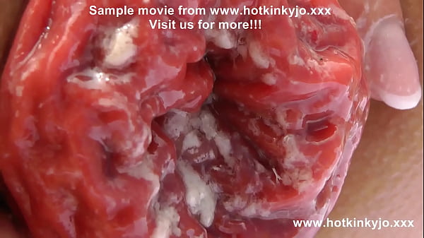 Play MP4 - Sexy self anal fisting on the beach & prolapse