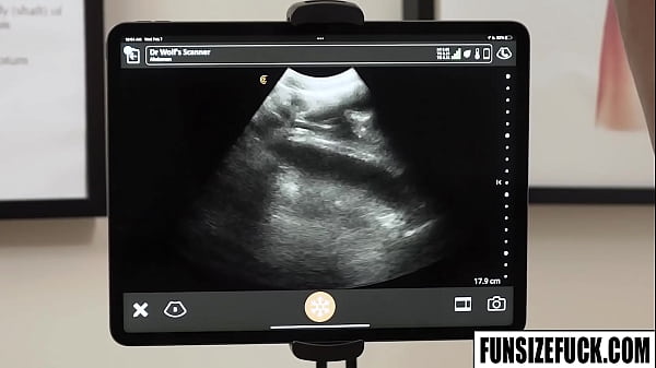 Noah White submits to doctor Legrand Wolf showing like a champ 