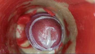 The camera inside the deep pussy records a huge ejaculation with a stuck condom