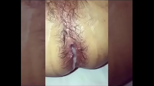 Bot phọt tinh tr&ugrave;ng &agrave;o ạt trong em 