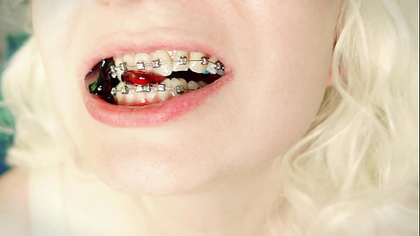 Hooot Asmr Video Great Sound Of Eating With Braces 4k thumbnail