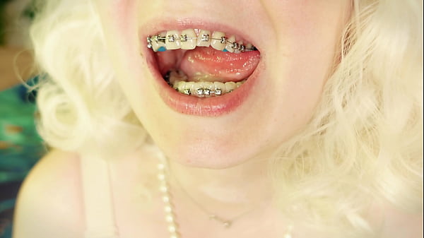 Hot Asmr Video Great Sound Of Eating With Braces 4k thumbnail