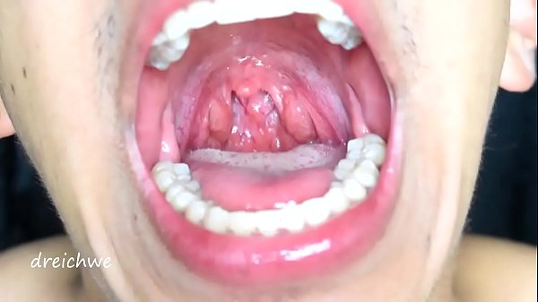 Exciting Uvula thumbnail