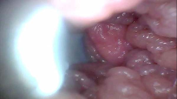 Endoscope camera shows the_most sensitive parts of_the penis Educational video