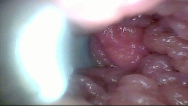 Nonton Endoscope Camera Shows The Most Sensitive Parts Of The Penis Educational Video thumbnail