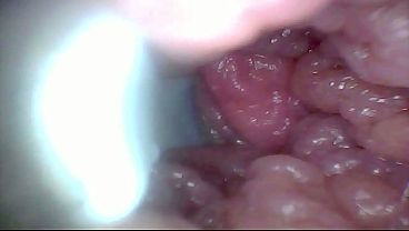 Endoscope camera shows the most sensitive parts of the penis Educational video