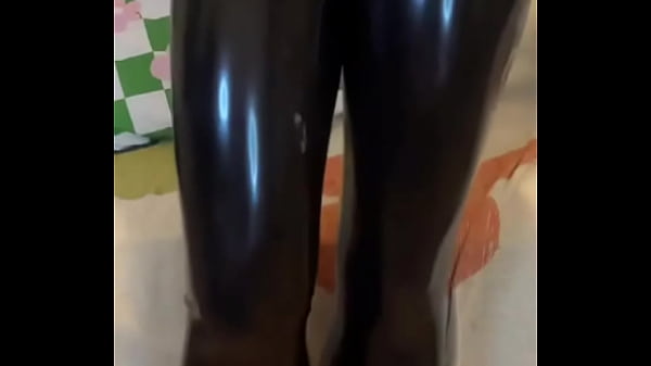 Ignore the patch on my leg 