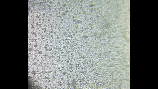 Tinh tr&ugrave_ng ch&iacute_nh chủ