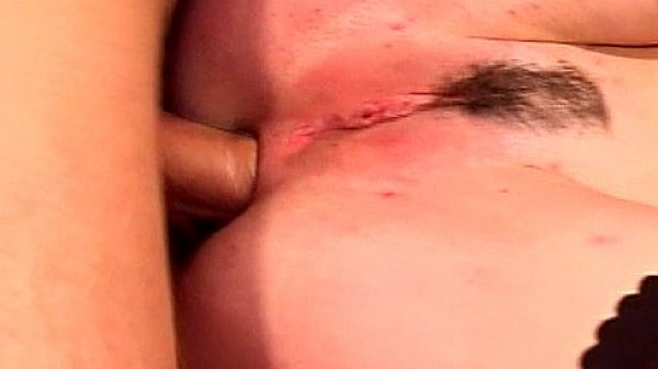 Metro - Stop My Ass Is On Fire 11 - scene 8 - extract 2 