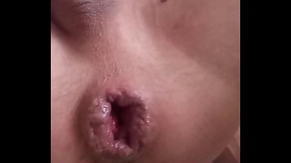 I Fisting Myself With A Big Bottle And My Prolapse Pops Out thumbnail