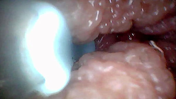 Nonton Visual Guide To G-spot Stimulation And Orgasm &mdash; Endoscop Perspective thumbnail