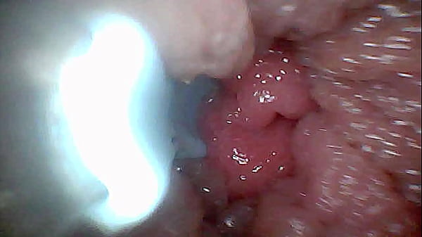 Visual guide to g spot stimulation and orgasm &mdash; endoscop perspective 