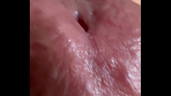 CABEZA ATRAPADA 