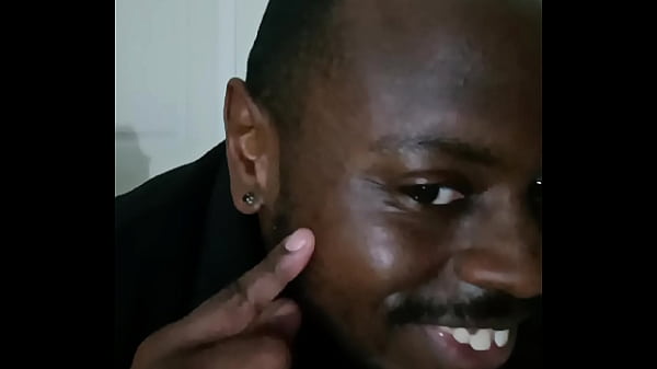 Introducing how my skin also gets sometimes when the weather gets hot and sunny in the summertime while wearing flasher coat to cover the rest of my body from developing too much allergies4 