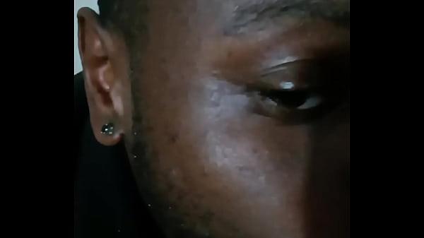 Introducing how my skin also gets sometimes when the weather gets hot and sunny in the summertime while wearing flasher coat to cover the rest of my body from developing too much allergies4 