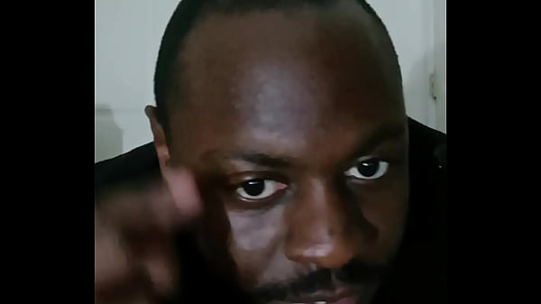 Introducing how my skin also gets sometimes when the weather gets hot and sunny in the summertime while wearing flasher coat to cover the rest of my body from developing too much allergies4