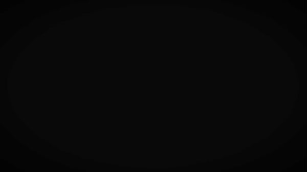 Nonton Escena Del D&iacute;a, Fernanda Garay Y Su Autentico Y Unico Vit&iacute;ligo Viene Por Su Casting.&iquest;c&oacute;mo Crees Que El Vit&iacute;ligo De F... thumbnail